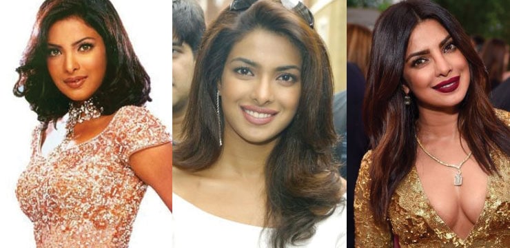 Priyanka Chopra Plastic Surgery Before And After Pictures 2018 