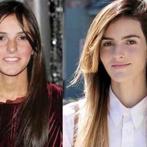 Ali Lohan Plastic Surgery