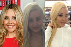 amanda bynes plastic surgery before and after photos
