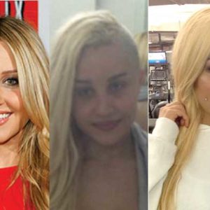 Amanda Bynes Plastic Surgery