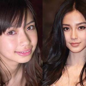 Angelababy Plastic Surgery