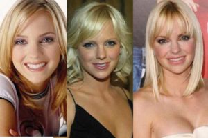 anna faris plastic surgery before and after photos