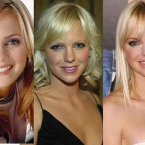 Anna Faris Plastic Surgery