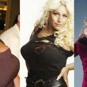 Beth Chapman Plastic Surgery