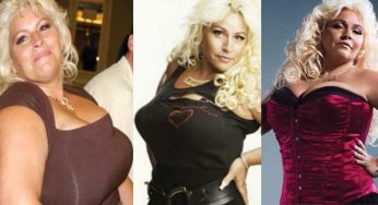 Beth Chapman Plastic Surgery