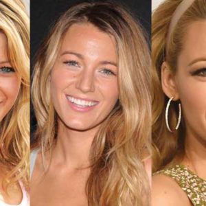 Blake Lively Plastic Surgery