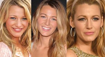 Blake Lively Plastic Surgery