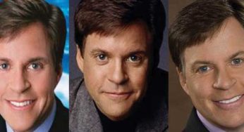 Bob Costas Plastic Surgery