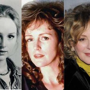 Bonnie Bedelia Plastic Surgery