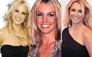 britney spears plastic surgery before and after photos