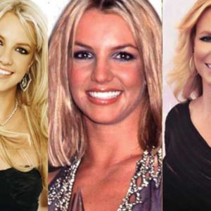 Britney Spears Plastic Surgery