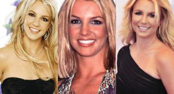 Britney Spears Plastic Surgery