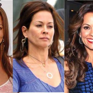 Brooke Burke Plastic Surgery