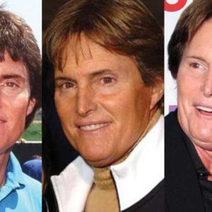 Bruce Jenner Plastic Surgery