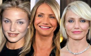 cameron diaz plastic surgery before and after photos