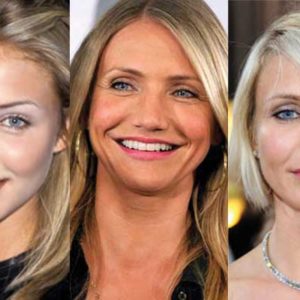 Cameron Diaz Plastic Surgery