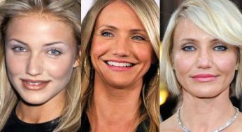 Cameron Diaz Plastic Surgery