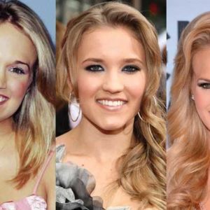 Carrie Underwood Plastic Surgery