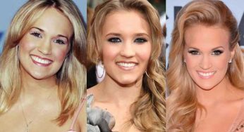 Carrie Underwood Plastic Surgery