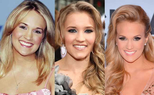 carrie underwood plastic surgery before and after photos