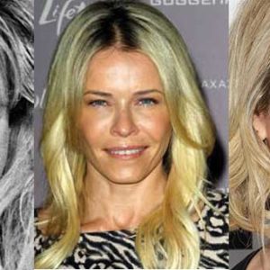 Chelsea Handler Plastic Surgery