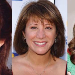 Cheri Oteri Plastic Surgery