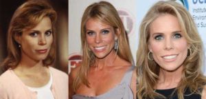 cheryl hines plastic surgery before and after photos