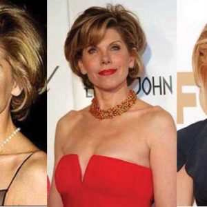 Christine Baranski Plastic Surgery