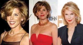 Christine Baranski Plastic Surgery