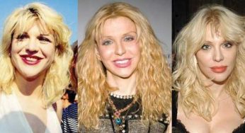 Courtney Love Plastic Surgery