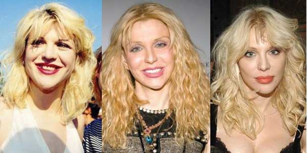 Courtney Love Plastic Surgery