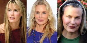 daryl hannah plastic surgery before and after photos