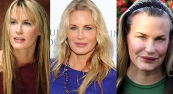 Daryl Hannah Plastic Surgery
