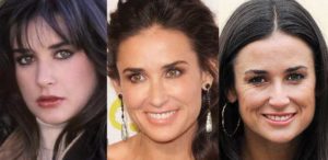 demi moore plastic surgery before and after photos