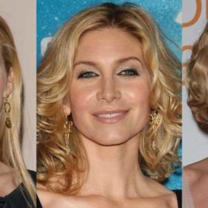 Elizabeth Mitchell Plastic Surgery