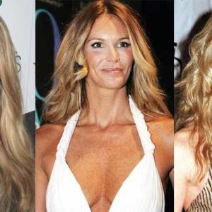 Elle MacPherson Plastic Surgery