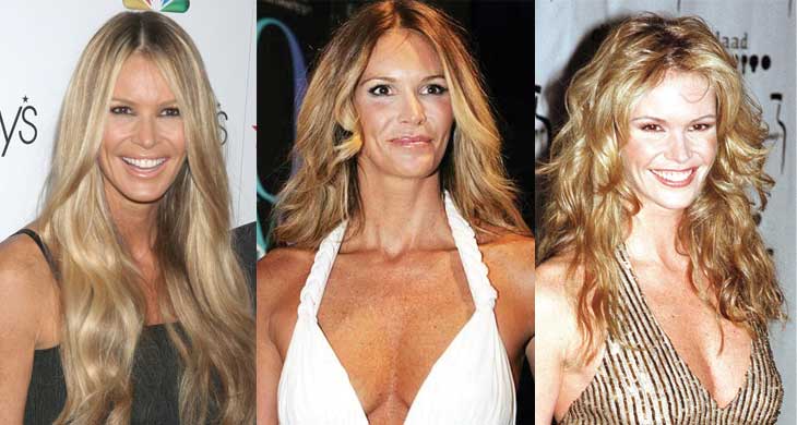 elle macpherson plastic surgery before and after photos