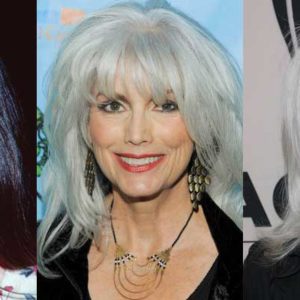 Emmylou Harris Plastic Surgery