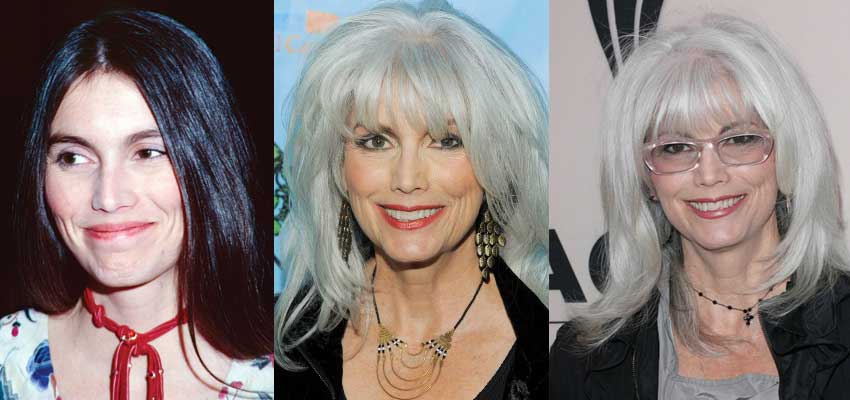 emmylou harris plastic surgery before and after photos