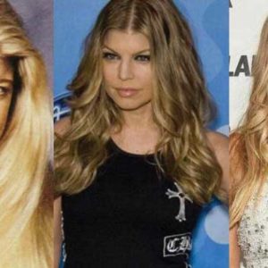 Fergie Plastic Surgery