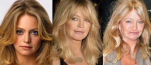 goldie hawn plastic surgery before and after photos