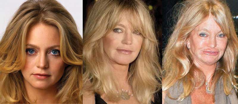 goldie hawn plastic surgery before and after photos 2023