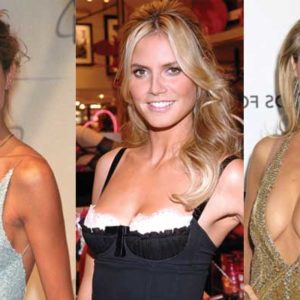 Heidi Klum Plastic Surgery