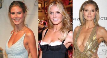 Heidi Klum Plastic Surgery