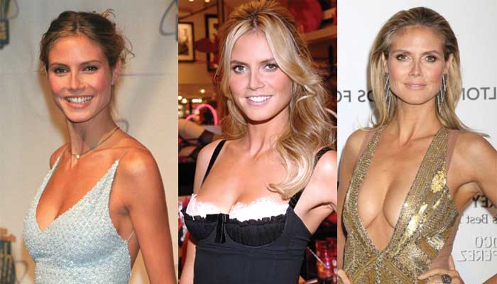 heidi klum plastic surgery before and after photos