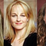 Helen Hunt Plastic Surgery