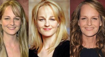 Helen Hunt Plastic Surgery