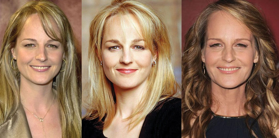 helen hunt before and after plastic surgery 2022