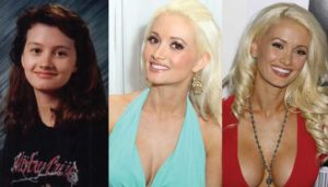 holly madison plastic surgery before and after photos