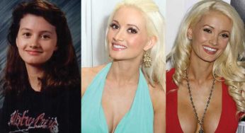 Holly Madison Plastic Surgery